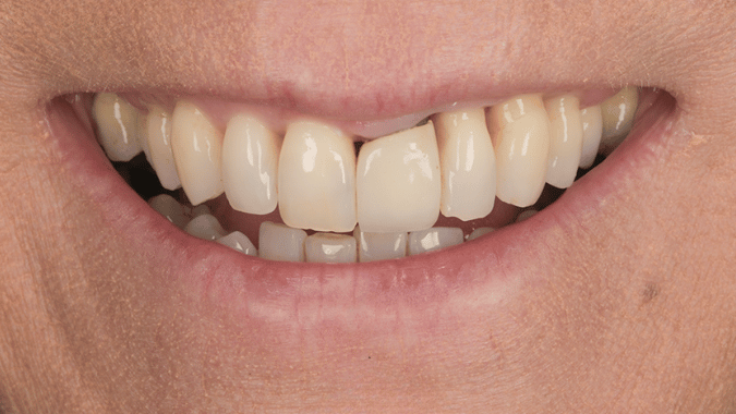 Before - Circ Dental