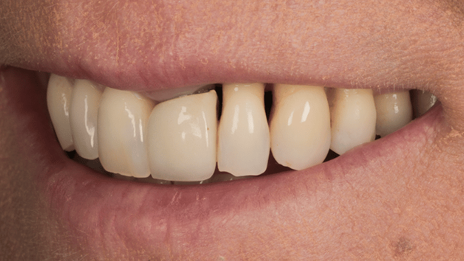 Before - Circ Dental