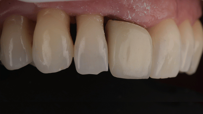 Before - Circ Dental