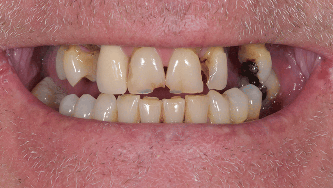 Before - Circ Dental