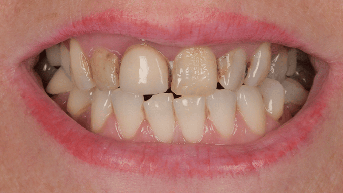 Before - Circ Dental