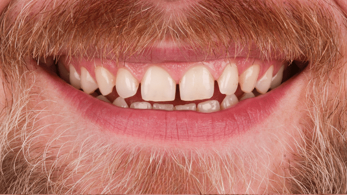 Before - Circ Dental