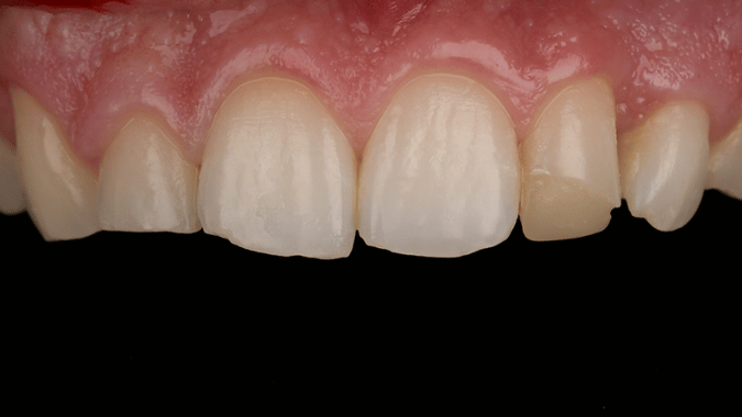 Before - Circ Dental