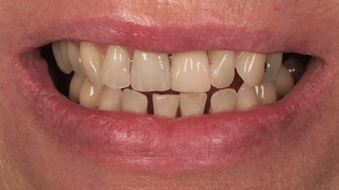Before - Circ Dental