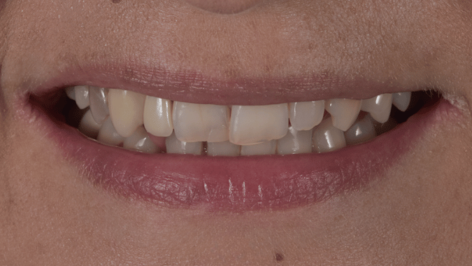 Before - Circ Dental