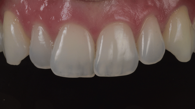 Before - Circ Dental