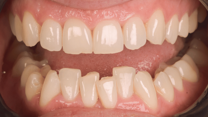 Before - Circ Dental