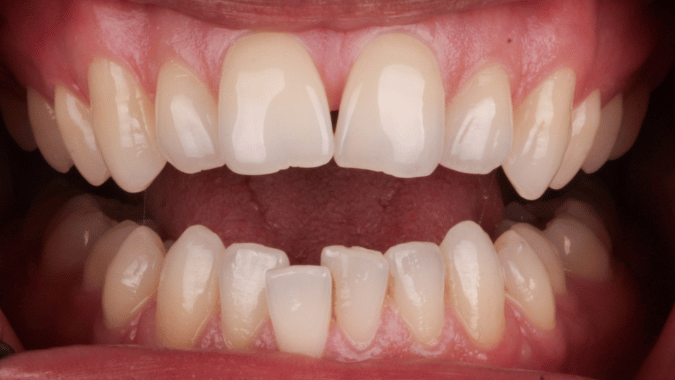 Before - Circ Dental