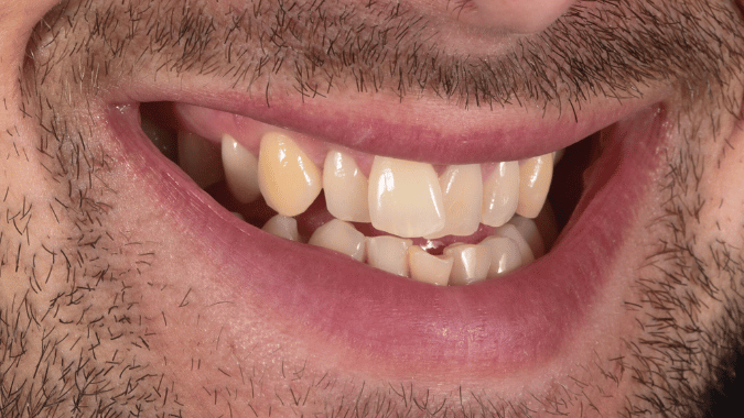 Before - Circ Dental