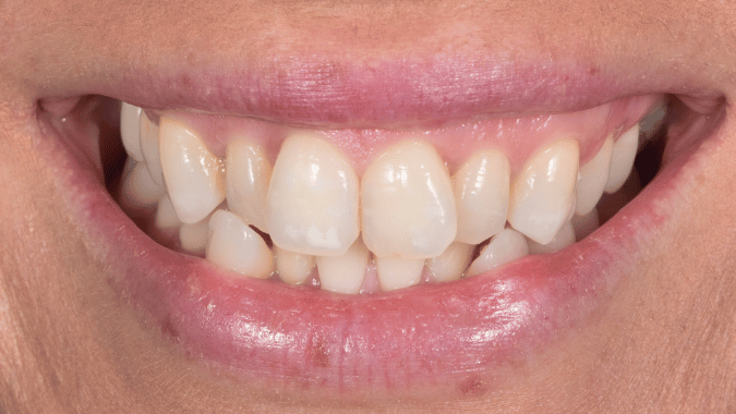 Before - Circ Dental