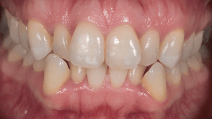 Before - Circ Dental