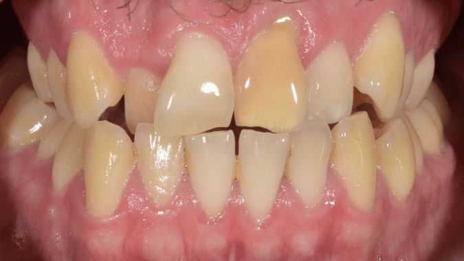 Before - Circ Dental