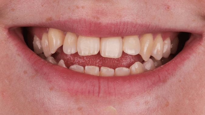 Before - Circ Dental