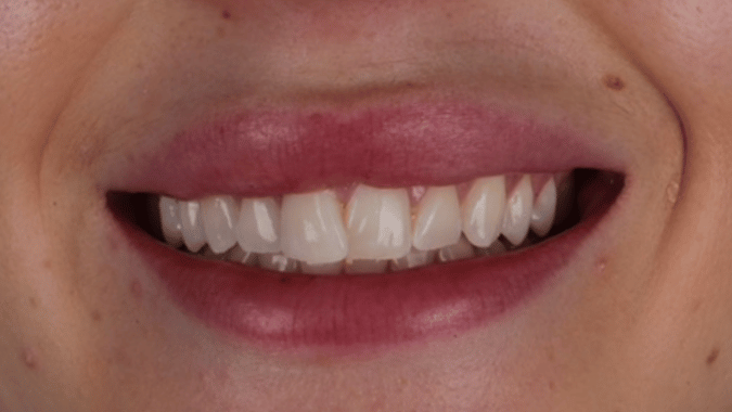Before - Circ Dental