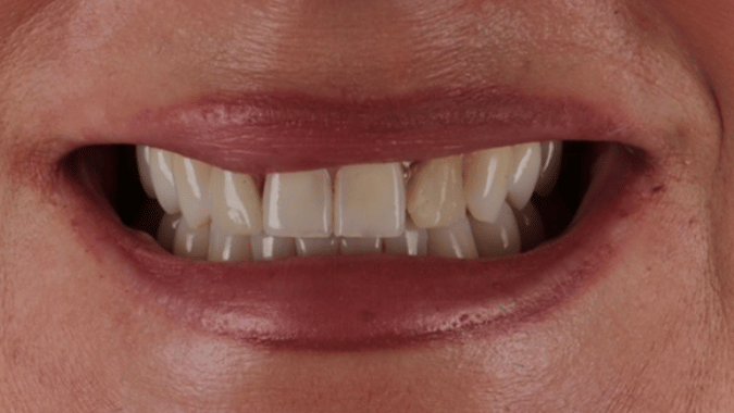 Before - Circ Dental