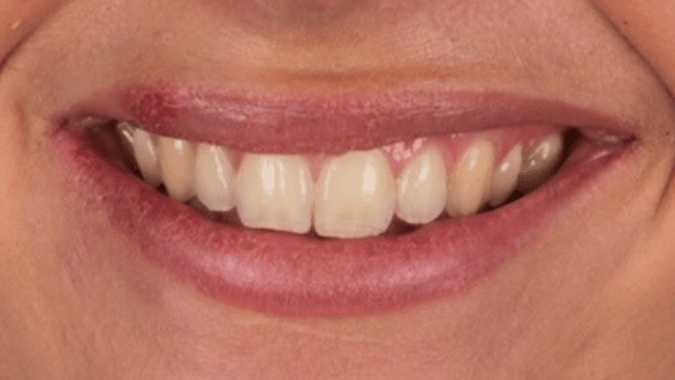 Before - Circ Dental