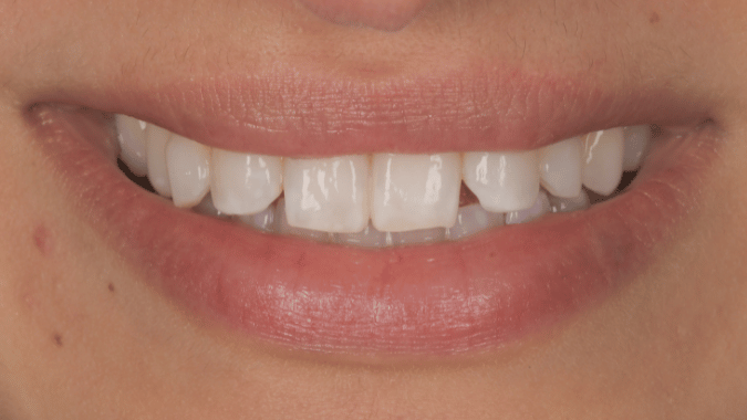 Before - Circ Dental