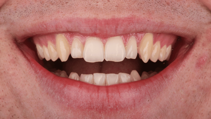 Before - Circ Dental