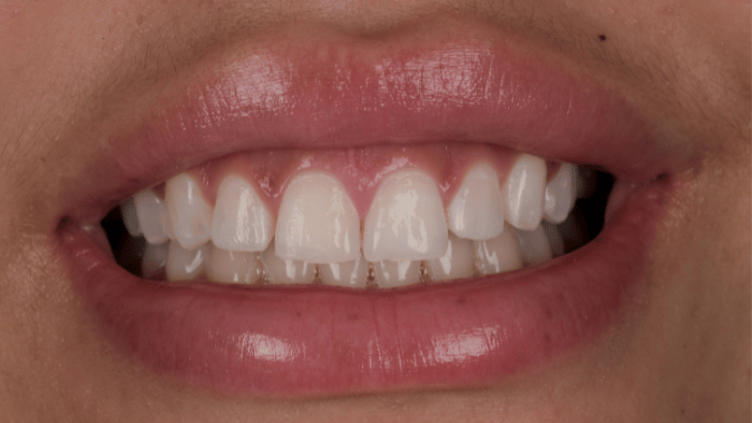 Before - Circ Dental